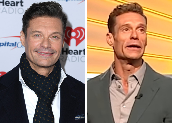 Extremely Skinny Look Of Ryan Seacrest&rsquo;s Face Worries Fans, As Hollywood Trend Seems To Grow