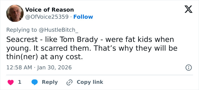 Extremely Skinny Look Of Ryan Seacrest&rsquo;s Face Worries Fans, As Hollywood Trend Seems To Grow