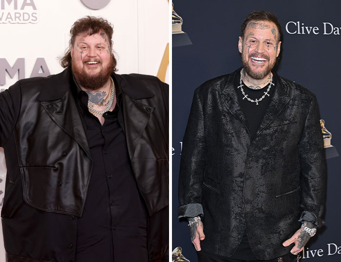 “How Is This Possible?”: Frenzy Over Botched Plastic Surgery And Weight Loss After The Grammys “How Is This Possible?”: Frenzy Over Botched Plastic Surgery And Weight Loss After The Grammys