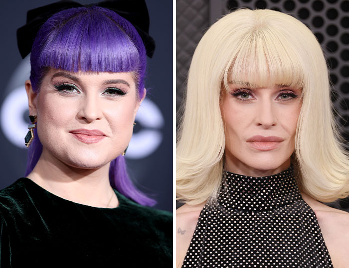 “How Is This Possible?”: Frenzy Over Botched Plastic Surgery And Weight Loss After The Grammys “How Is This Possible?”: Frenzy Over Botched Plastic Surgery And Weight Loss After The Grammys