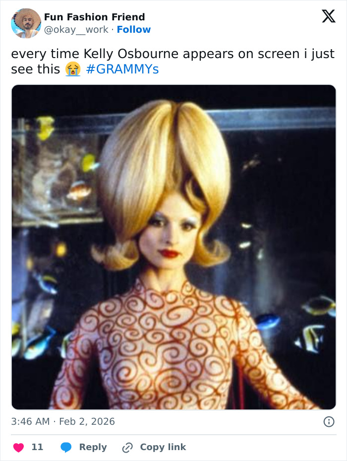 “How Is This Possible?”: Frenzy Over Botched Plastic Surgery And Weight Loss After The Grammys “How Is This Possible?”: Frenzy Over Botched Plastic Surgery And Weight Loss After The Grammys