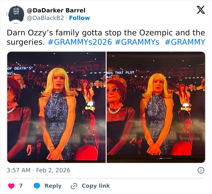 “How Is This Possible?”: Frenzy Over Botched Plastic Surgery And Weight Loss After The Grammys “How Is This Possible?”: Frenzy Over Botched Plastic Surgery And Weight Loss After The Grammys