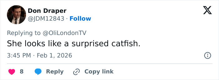 “How Is This Possible?”: Frenzy Over Botched Plastic Surgery And Weight Loss After The Grammys “How Is This Possible?”: Frenzy Over Botched Plastic Surgery And Weight Loss After The Grammys