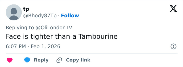 “How Is This Possible?”: Frenzy Over Botched Plastic Surgery And Weight Loss After The Grammys “How Is This Possible?”: Frenzy Over Botched Plastic Surgery And Weight Loss After The Grammys