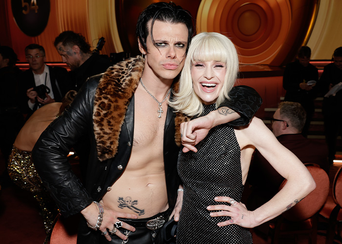 “Needs To See A Doctor”: Odd Detail In Kelly Osbourne Photo Sparks Fan Concern