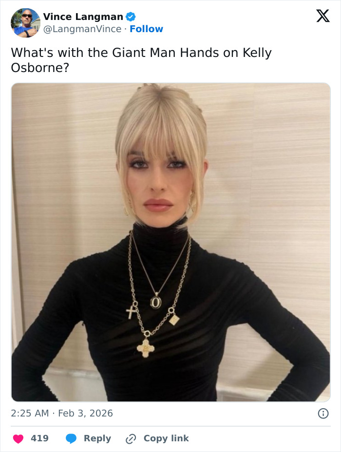 “Needs To See A Doctor”: Odd Detail In Kelly Osbourne Photo Sparks Fan Concern