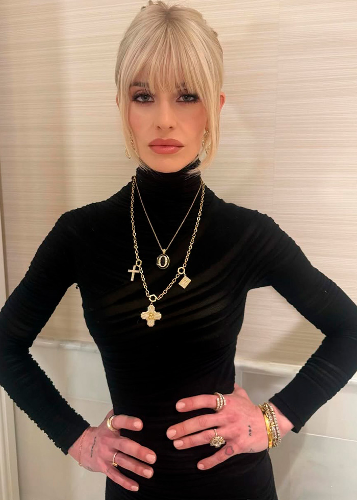 “Needs To See A Doctor”: Odd Detail In Kelly Osbourne Photo Sparks Fan Concern