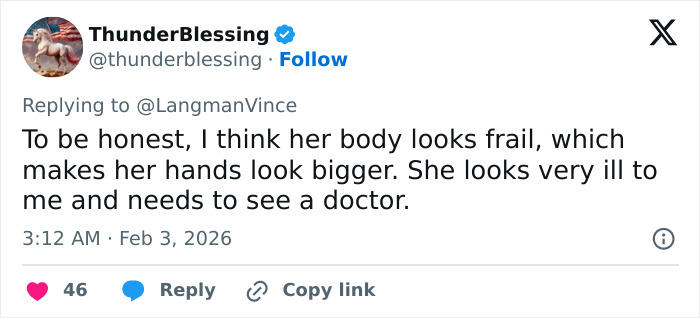 “Needs To See A Doctor”: Odd Detail In Kelly Osbourne Photo Sparks Fan Concern