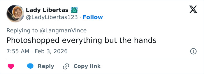 “Needs To See A Doctor”: Odd Detail In Kelly Osbourne Photo Sparks Fan Concern