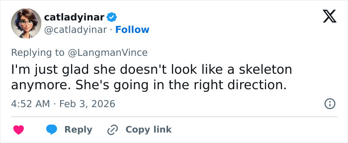 “Needs To See A Doctor”: Odd Detail In Kelly Osbourne Photo Sparks Fan Concern