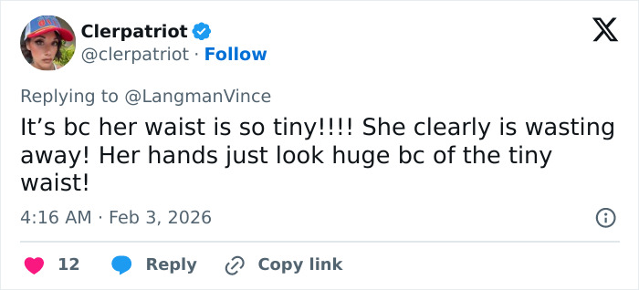 “Needs To See A Doctor”: Odd Detail In Kelly Osbourne Photo Sparks Fan Concern