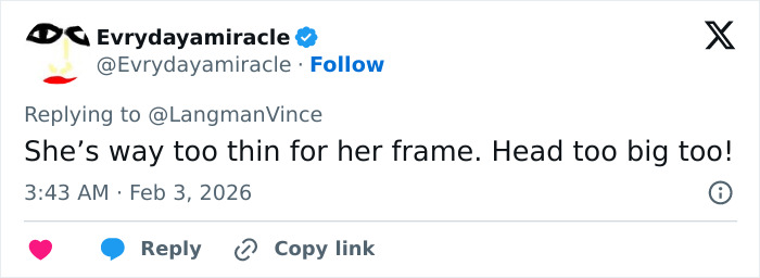 “Needs To See A Doctor”: Odd Detail In Kelly Osbourne Photo Sparks Fan Concern