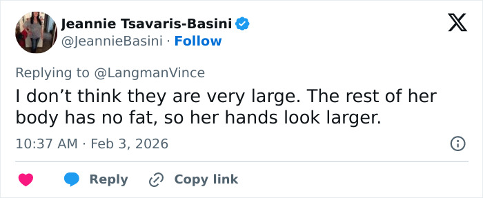 “Needs To See A Doctor”: Odd Detail In Kelly Osbourne Photo Sparks Fan Concern