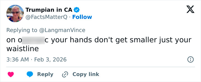 “Needs To See A Doctor”: Odd Detail In Kelly Osbourne Photo Sparks Fan Concern