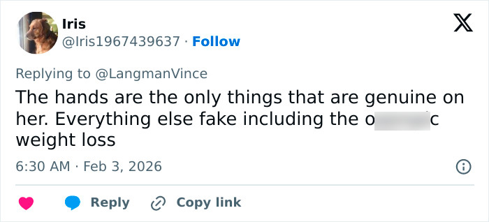 “Needs To See A Doctor”: Odd Detail In Kelly Osbourne Photo Sparks Fan Concern