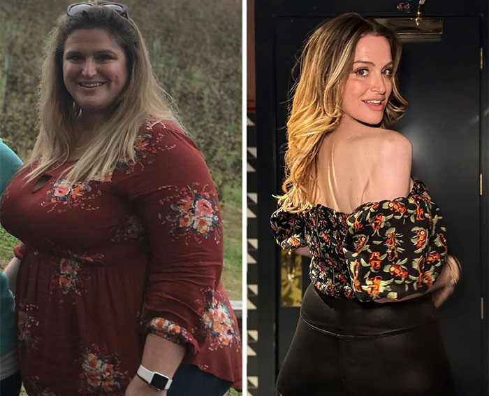 “I’ll Take Ozempic Face”: 77 People Share The Dramatic Facial Changes That Came With Their Ozempic Journey “I’ll Take Ozempic Face”: 77 People Share The Dramatic Facial Changes That Came With Their Ozempic Journey