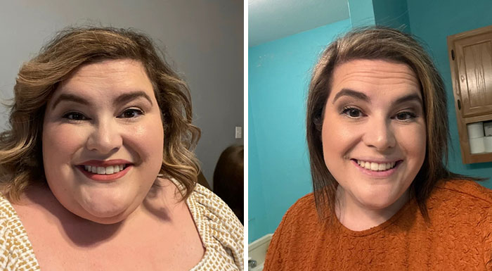 “I’ll Take Ozempic Face”: 77 People Share The Dramatic Facial Changes That Came With Their Ozempic Journey “I’ll Take Ozempic Face”: 77 People Share The Dramatic Facial Changes That Came With Their Ozempic Journey