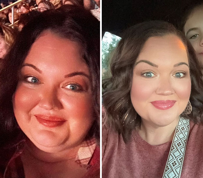“I’ll Take Ozempic Face”: 77 People Share The Dramatic Facial Changes That Came With Their Ozempic Journey “I’ll Take Ozempic Face”: 77 People Share The Dramatic Facial Changes That Came With Their Ozempic Journey