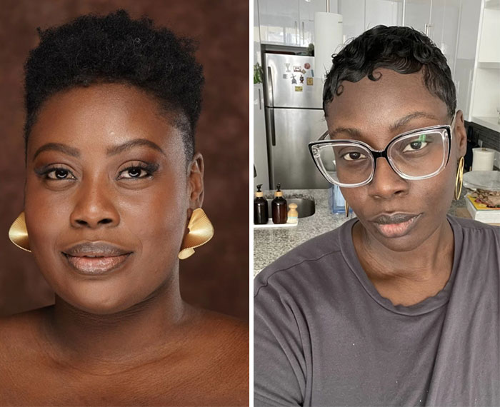 “I’ll Take Ozempic Face”: 77 People Share The Dramatic Facial Changes That Came With Their Ozempic Journey “I’ll Take Ozempic Face”: 77 People Share The Dramatic Facial Changes That Came With Their Ozempic Journey