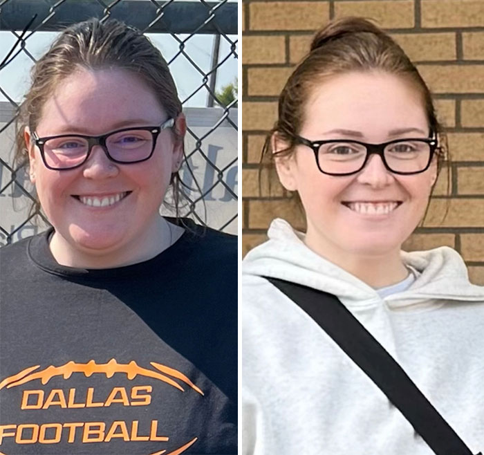 “I’ll Take Ozempic Face”: 77 People Share The Dramatic Facial Changes That Came With Their Ozempic Journey “I’ll Take Ozempic Face”: 77 People Share The Dramatic Facial Changes That Came With Their Ozempic Journey