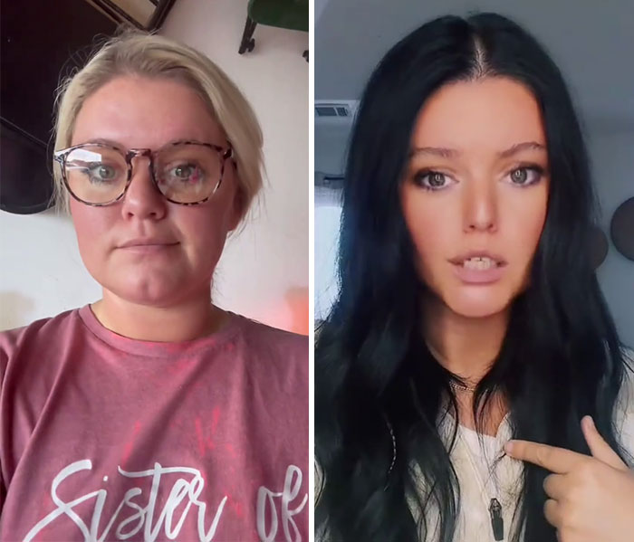 “I’ll Take Ozempic Face”: 77 People Share The Dramatic Facial Changes That Came With Their Ozempic Journey “I’ll Take Ozempic Face”: 77 People Share The Dramatic Facial Changes That Came With Their Ozempic Journey