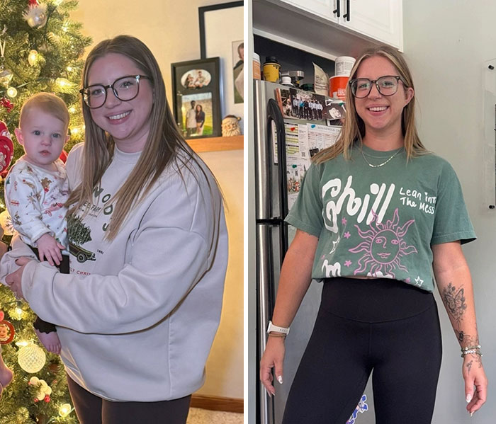 “I’ll Take Ozempic Face”: 77 People Share The Dramatic Facial Changes That Came With Their Ozempic Journey “I’ll Take Ozempic Face”: 77 People Share The Dramatic Facial Changes That Came With Their Ozempic Journey