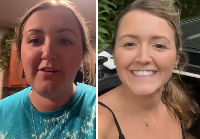 “I’ll Take Ozempic Face”: 77 People Share The Dramatic Facial Changes That Came With Their Ozempic Journey “I’ll Take Ozempic Face”: 77 People Share The Dramatic Facial Changes That Came With Their Ozempic Journey