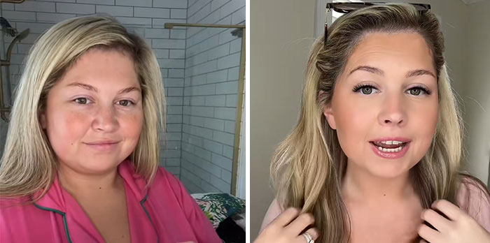 “I’ll Take Ozempic Face”: 77 People Share The Dramatic Facial Changes That Came With Their Ozempic Journey “I’ll Take Ozempic Face”: 77 People Share The Dramatic Facial Changes That Came With Their Ozempic Journey