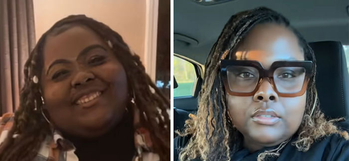 “I’ll Take Ozempic Face”: 77 People Share The Dramatic Facial Changes That Came With Their Ozempic Journey “I’ll Take Ozempic Face”: 77 People Share The Dramatic Facial Changes That Came With Their Ozempic Journey