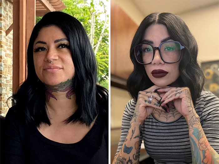 “I’ll Take Ozempic Face”: 77 People Share The Dramatic Facial Changes That Came With Their Ozempic Journey “I’ll Take Ozempic Face”: 77 People Share The Dramatic Facial Changes That Came With Their Ozempic Journey