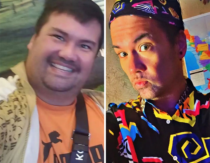 “I’ll Take Ozempic Face”: 77 People Share The Dramatic Facial Changes That Came With Their Ozempic Journey “I’ll Take Ozempic Face”: 77 People Share The Dramatic Facial Changes That Came With Their Ozempic Journey