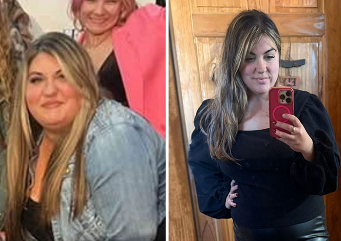 “I’ll Take Ozempic Face”: 77 People Share The Dramatic Facial Changes That Came With Their Ozempic Journey “I’ll Take Ozempic Face”: 77 People Share The Dramatic Facial Changes That Came With Their Ozempic Journey