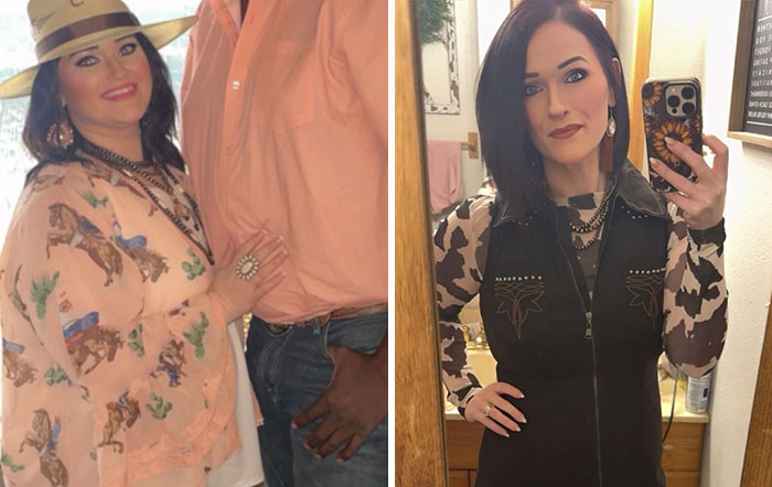 “I’ll Take Ozempic Face”: 77 People Share The Dramatic Facial Changes That Came With Their Ozempic Journey “I’ll Take Ozempic Face”: 77 People Share The Dramatic Facial Changes That Came With Their Ozempic Journey