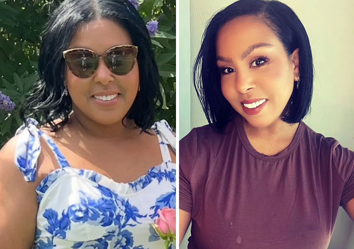 “I’ll Take Ozempic Face”: 77 People Share The Dramatic Facial Changes That Came With Their Ozempic Journey “I’ll Take Ozempic Face”: 77 People Share The Dramatic Facial Changes That Came With Their Ozempic Journey