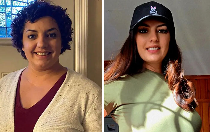 “I’ll Take Ozempic Face”: 77 People Share The Dramatic Facial Changes That Came With Their Ozempic Journey “I’ll Take Ozempic Face”: 77 People Share The Dramatic Facial Changes That Came With Their Ozempic Journey