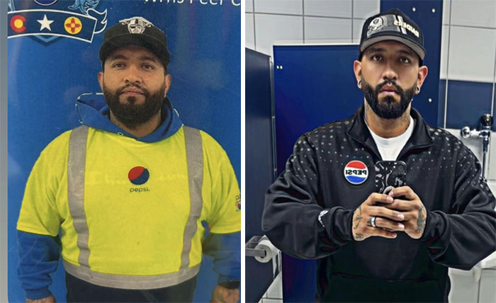 “I’ll Take Ozempic Face”: 77 People Share The Dramatic Facial Changes That Came With Their Ozempic Journey “I’ll Take Ozempic Face”: 77 People Share The Dramatic Facial Changes That Came With Their Ozempic Journey