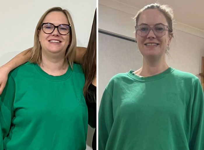 “I’ll Take Ozempic Face”: 77 People Share The Dramatic Facial Changes That Came With Their Ozempic Journey “I’ll Take Ozempic Face”: 77 People Share The Dramatic Facial Changes That Came With Their Ozempic Journey