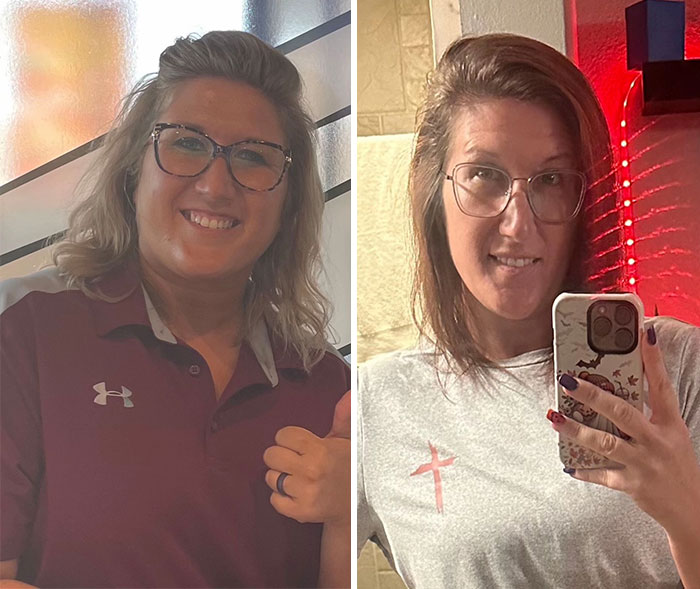 “I’ll Take Ozempic Face”: 77 People Share The Dramatic Facial Changes That Came With Their Ozempic Journey “I’ll Take Ozempic Face”: 77 People Share The Dramatic Facial Changes That Came With Their Ozempic Journey