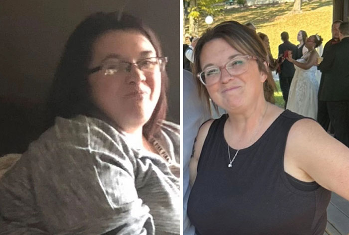 “I’ll Take Ozempic Face”: 77 People Share The Dramatic Facial Changes That Came With Their Ozempic Journey “I’ll Take Ozempic Face”: 77 People Share The Dramatic Facial Changes That Came With Their Ozempic Journey