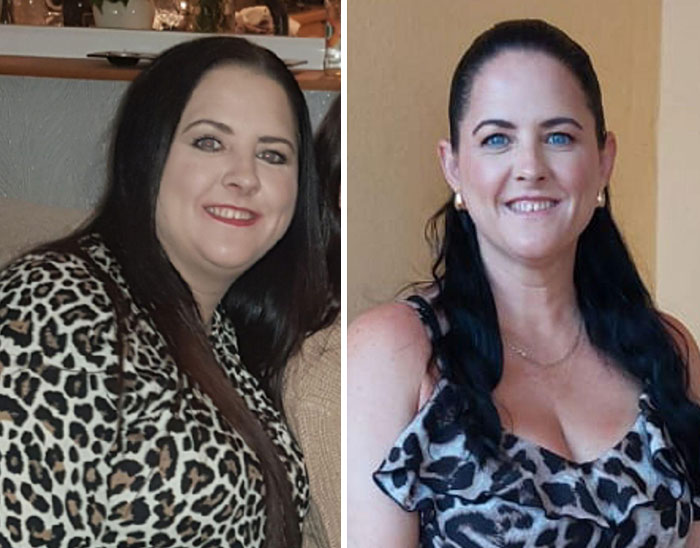 “I’ll Take Ozempic Face”: 77 People Share The Dramatic Facial Changes That Came With Their Ozempic Journey “I’ll Take Ozempic Face”: 77 People Share The Dramatic Facial Changes That Came With Their Ozempic Journey