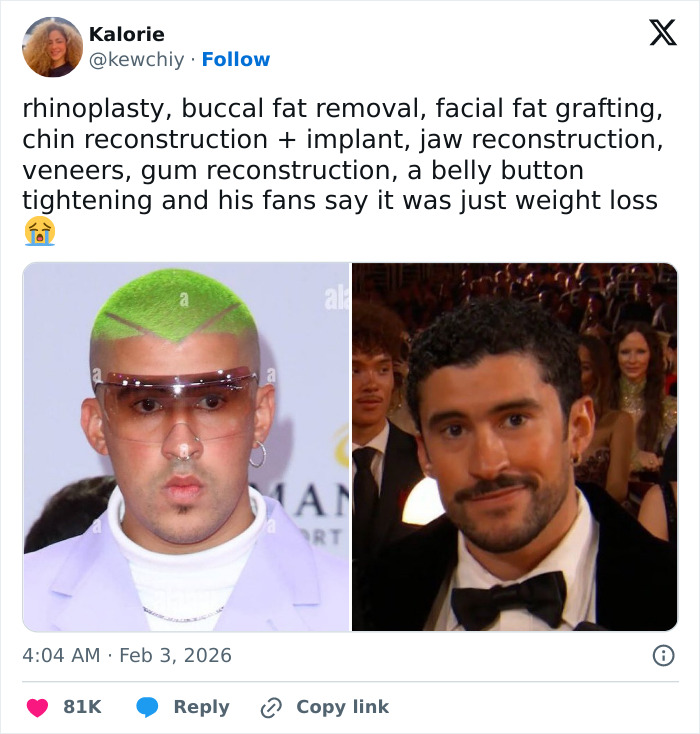 Bad Bunny’s “Immaculate” Transformation Goes Viral After His Historical Grammy Win