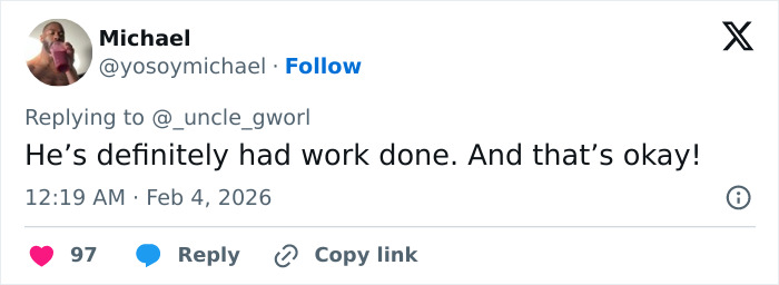 Bad Bunny’s “Immaculate” Transformation Goes Viral After His Historical Grammy Win