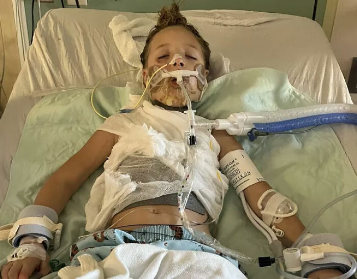 9-Year-Old Suffers Severe Facial Burns After Dangerous TikTok Trend Goes Horribly Wrong