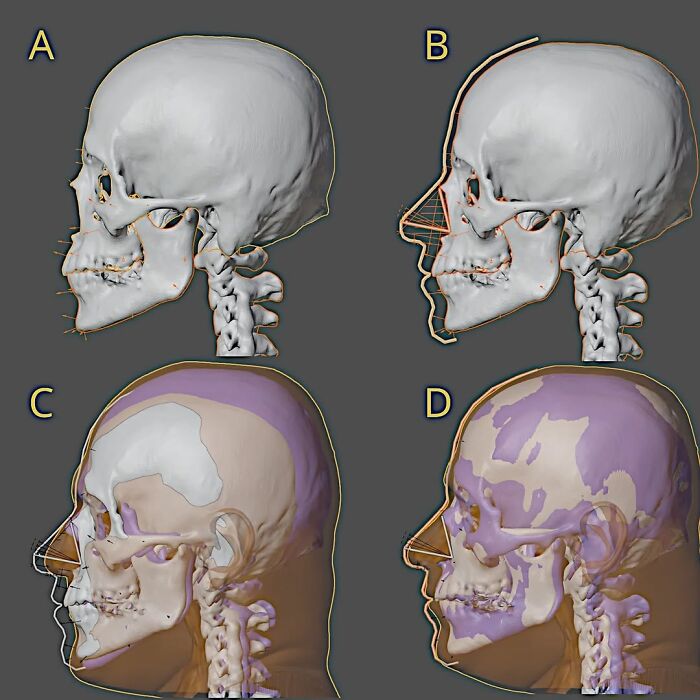 A Scientist Used Skull Scans And Portraits To Recreate The Faces Of Mozart, Bach, And Beethoven