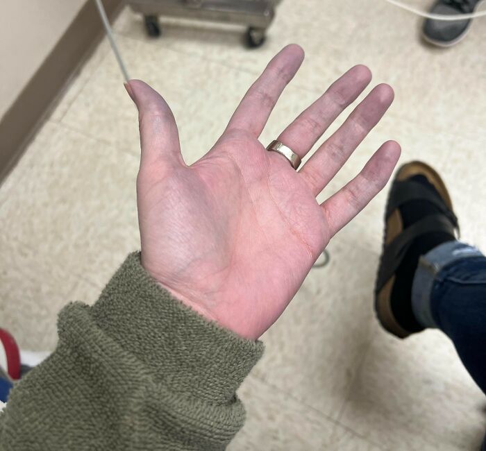 People Are Sharing The Most Unserious Reasons They Needed To Go To ER