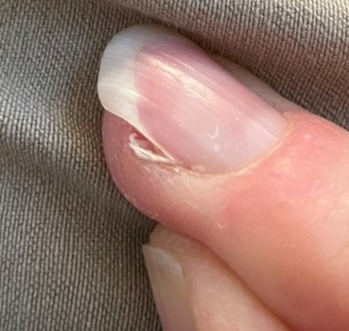 People Are Sharing The Most Unserious Reasons They Needed To Go To ER