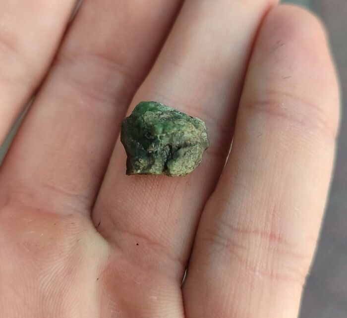 People Are Sharing The Most Unserious Reasons They Needed To Go To ER