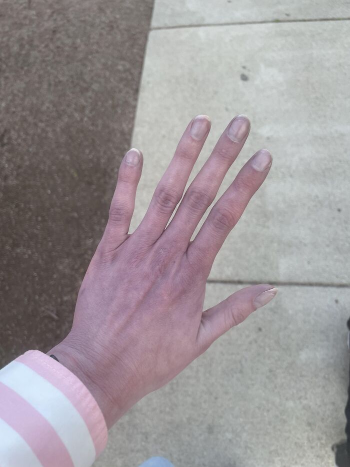 People Are Sharing The Most Unserious Reasons They Needed To Go To ER