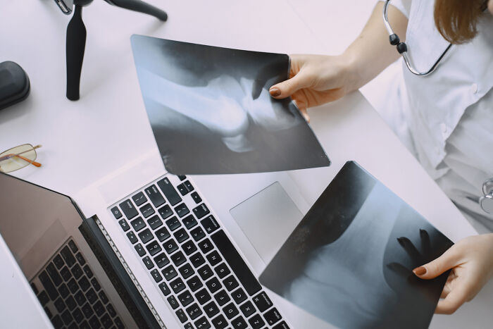 People Are Sharing The Most Unserious Reasons They Needed To Go To ER