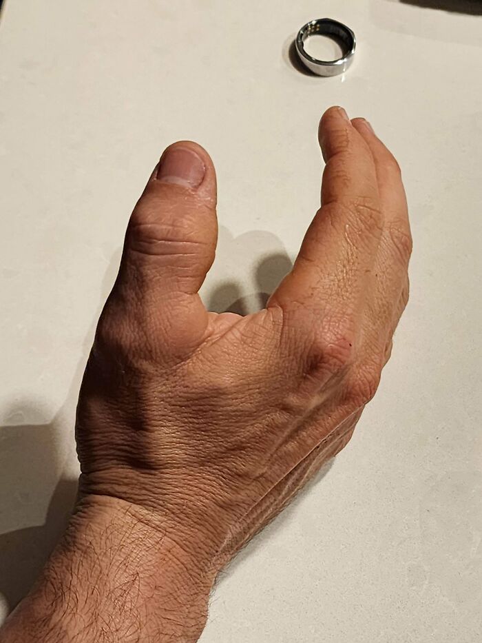 ‘Absolute Units’: 82 Times People Saw Something So Big, They Just Had To Share (New Pics) ‘Absolute Units’: 82 Times People Saw Something So Big, They Just Had To Share (New Pics)